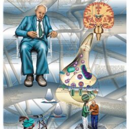 Anatomical Chart - Parkinson's Disease,  laminated